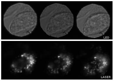 Chinese Hamster Ovaries (CHO) with DsRed present in cell mitochondria - 3D fluorescence and brightfield imaging
