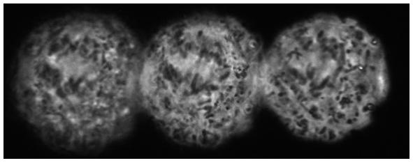 African green monkey kidney (Vero) cells during mitosis (anaphase) - 3D phase contrast imaging