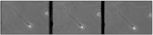 A human sperm cell imaged on 3 planes simultaneously...